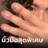 หนุ่มนิ้วโปนถูกบูลลี่ทั้งชีวิต พลิกวิกฤตจนกลายเป็นช่างผมชื่อดัง ลูกค้าแห่ต่อคิวใช้บริการ